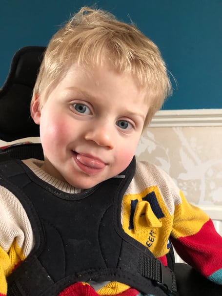 Hugo, who has been diagnosed with a rare condition.