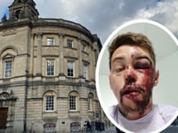 Cyclist injured by pothole 'offered no help by council'
