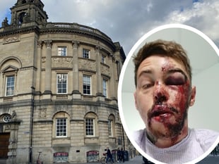 Cyclist injured by pothole 'offered no help by council'