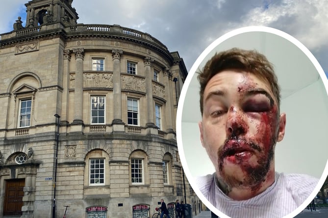 William Bullock after the accident with (background) the Guildhall where Bath and North East Somerset Council meet (Image: (inset) William Bullock and (background) John Wimperis)