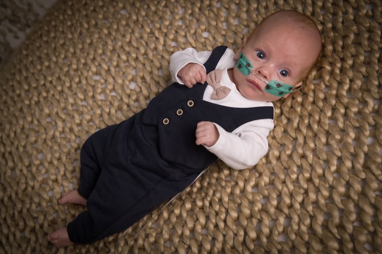 Loki, who was born 10 weeks early.