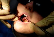 More than 100 hospital admissions in North Somerset to remove children's rotten teeth