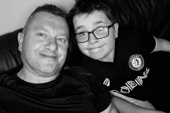 Father and son competing in marathon to support those affected by cleft