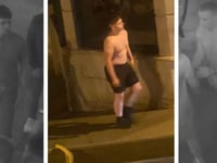 Police appeal after serious assault left man with fractured skull
