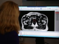 More men diagnosed with prostate cancer in Bristol, north Somerset and South Gloucestershire