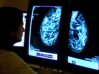 More women in Bath and North East Somerset undergo breast cancer screening – as NHS England target met for first in five years